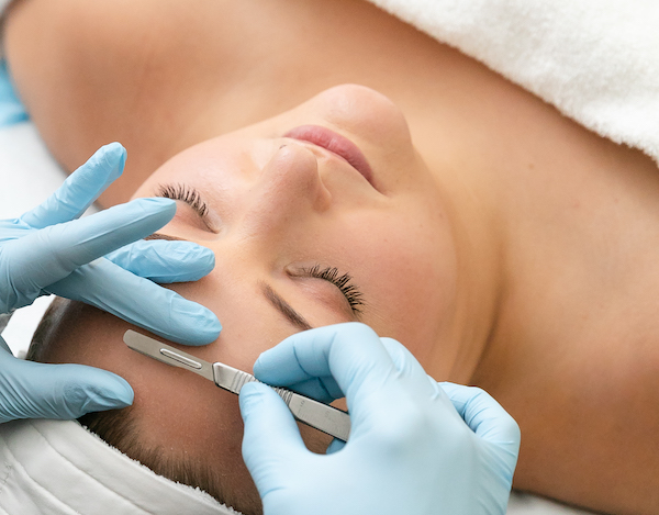 Dermaplaning treatment