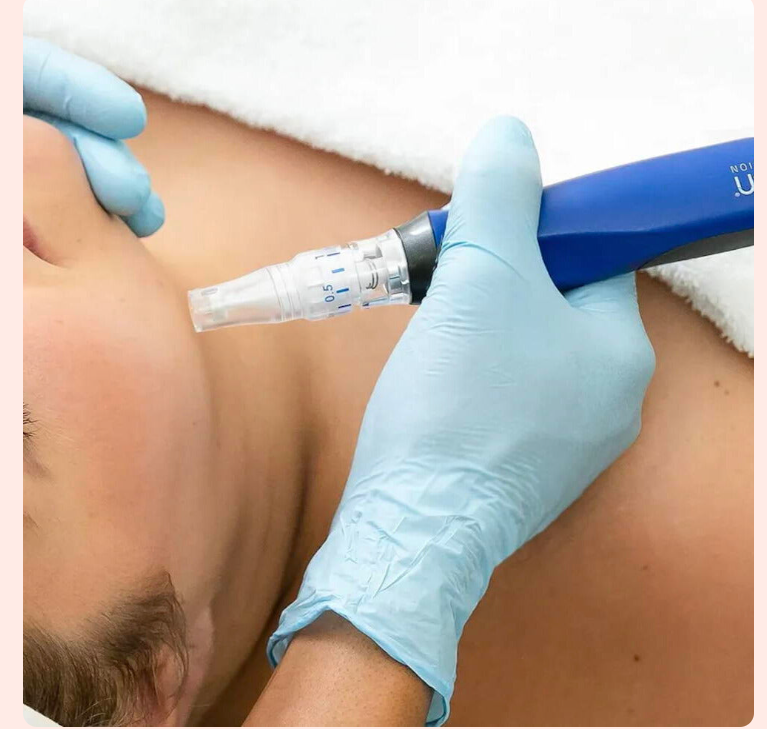 SkinPen Microneedling